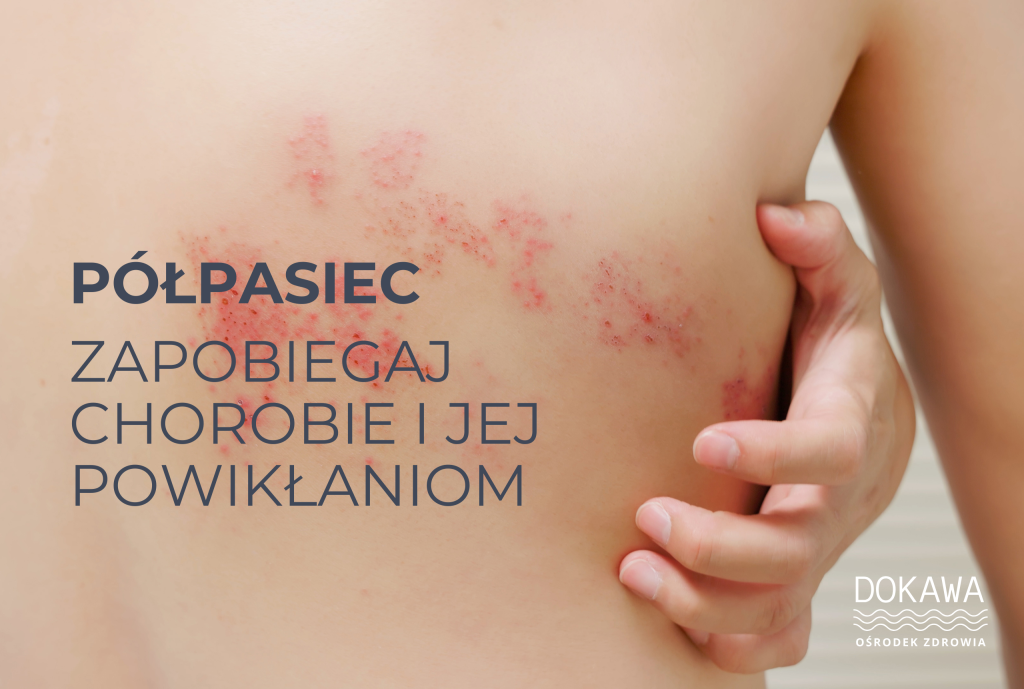 szczepienie przeciwko półpaściowi